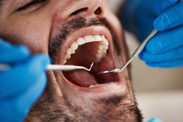 Best Emergency Dental Care for Sports Injuries in Emory, VA
